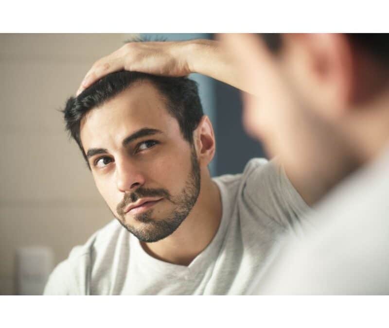Hair Loss in Men a Sign of Low Testosterone?