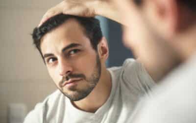 Hair Loss in Men a Sign of Low Testosterone?