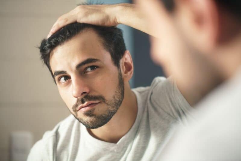 Hair Loss in Men a Sign of Low Testosterone?